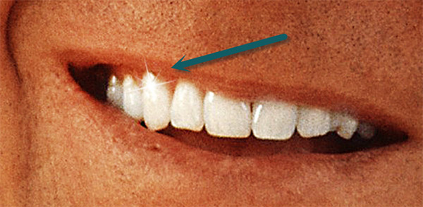 كيفية تبييض الأسنان في برنامج فوتوشوب 11